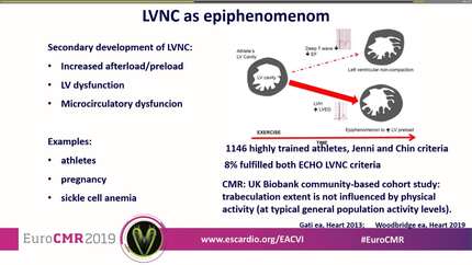 Left ventricular non-compaction: trait, phenotype or disease.
