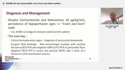 COVID-19 and myocarditis: one virus may hide another.