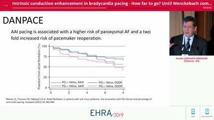 Intrinsic conduction enhancement in bradycardia pacing - How far to go?  Until Wenckebach comes?
