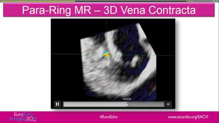 Presentation thumbnail