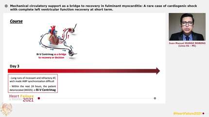 Mechanical circulatory support as a bridge to recovery in fulminant myocarditis: A rare case of cardiogenic shock with complete left ventricular function recovery at short term.