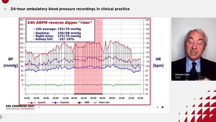 24-hour ambulatory blood pressure recordings in clinical practice