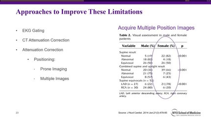 Myocardial perfusion imaging in women - State-of-the-evidence
