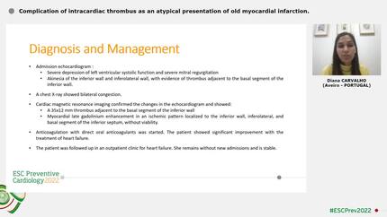 Complication of intracardiac thrombus as an atypical presentation of old myocardial infarction.