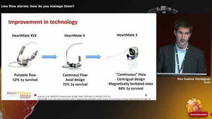 Low flow alarms: how do you manage them?
