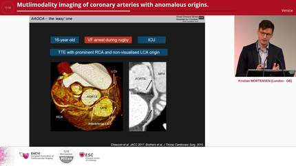 Presentation thumbnail