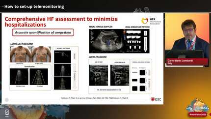 How to set-up a heart failure clinic and integrate healthcare professionals