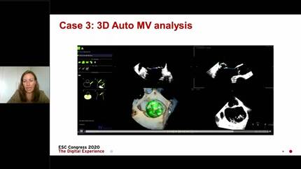 Presentation thumbnail