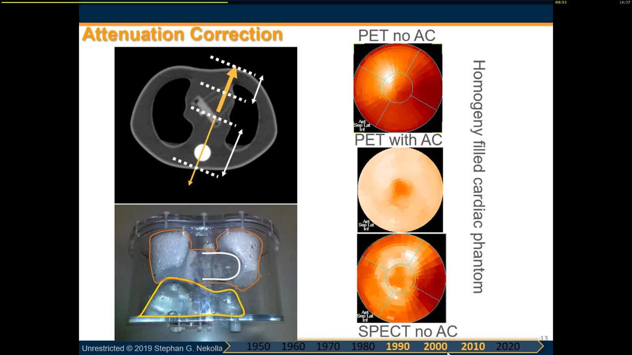 Hybrid and fusion imaging - Technical background