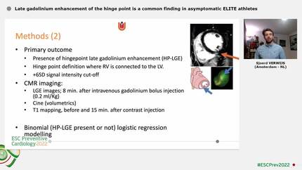 Late gadolinium enhancement of the hinge point is a common finding in asymptomatic ELITE athletes