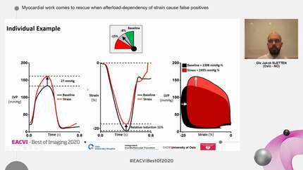 Myocardial work comes to rescue when afterload-dependency of strain cause false positives
