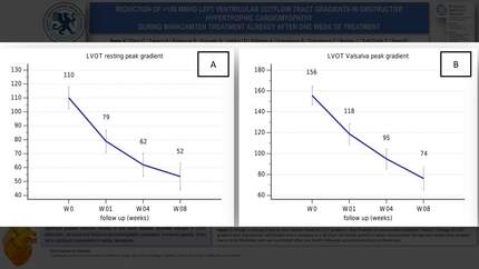Reduction of >100 mmHg left ventricular outflow tract gradients in obstructive hypertrophic cardiomyopathy during mavacamten treatment already after one week of treatment