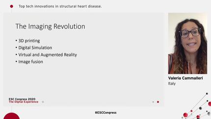 Top tech innovations in structural heart disease.
