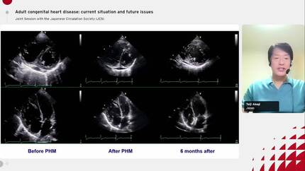 Current therapeutic strategies and long-term outcome of adult atrial septal defect associated with pulmonary hypertension.