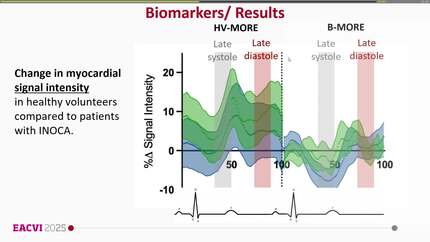 Breathing-enhanced oxygenation-sensitive cardiac magnetic resonance imaging to identify coronary microvascular and vasomotor dysfunction in patients with ischemia and no obstructive CAD