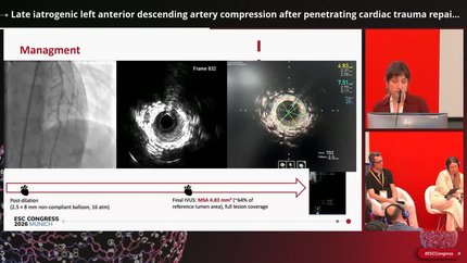 Late iatrogenic left anterior descending artery compression after penetrating cardiac trauma repair in an adolescent