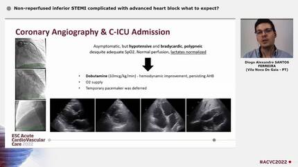 Non-reperfused inferior STEMI complicated with advanced heart block  what to expect?