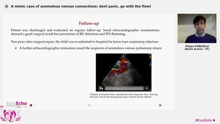 A mimic case of anomalous venous connections: dont panic, go with the flow!