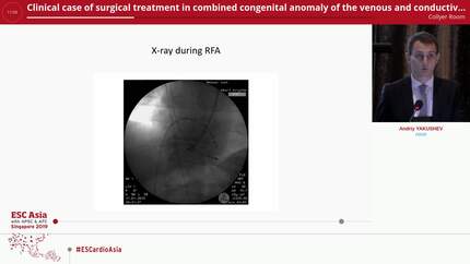 Clinical case of surgical treatment in combined congenital anomaly of the venous and conductive systems of the heart.