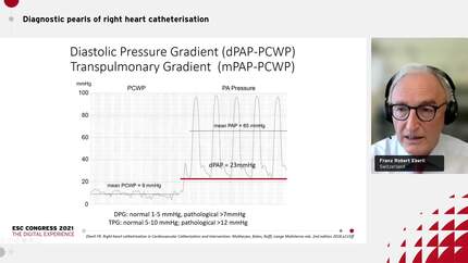 Diagnostic pearls of right heart catheterisation