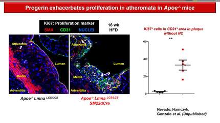 How to protect the heart against multiple comorbidities in ageing