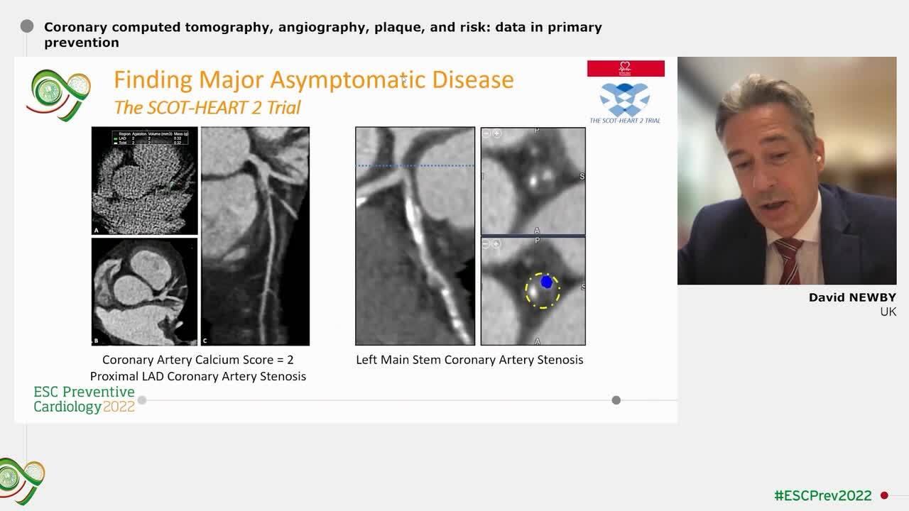 Is there a role for computed tomography to guide primary prevention?