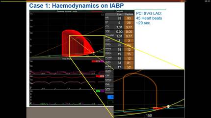 The Science of hemodynamics and clinical relevance.
