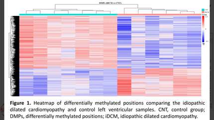 Methylome-driven regulation of miRNA expression in dilated cardiomyopathy 