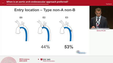 When is an aortic arch endovascular approach preferred?