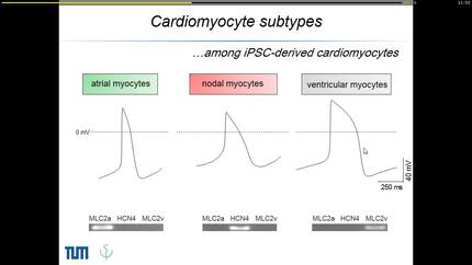 Decyphering arrhythmia mechanisms using human iPSC-derived cardiomyocytes.
