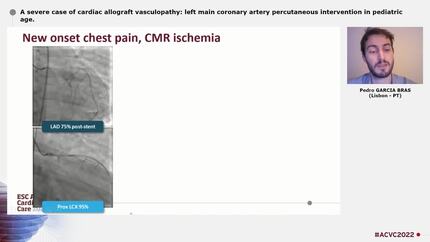 A severe case of cardiac allograft vasculopathy: left main coronary artery percutaneous intervention in pediatric age.