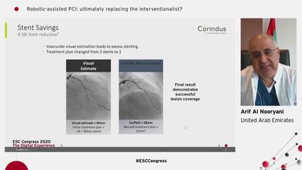 Robotic-assisted PCI: ultimately replacing the interventionalist?