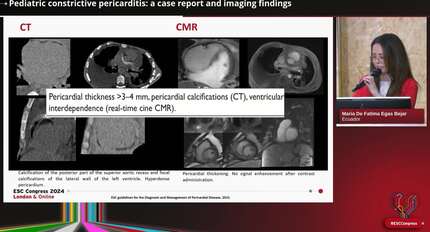 Presentation thumbnail