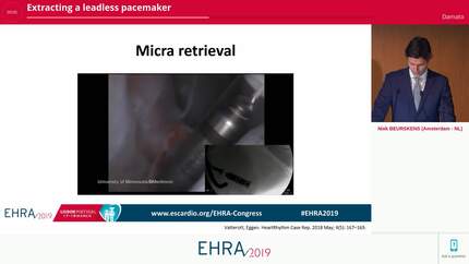 Extracting a leadless pacemaker