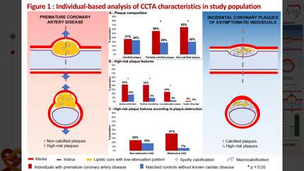 Phenotyping coronary plaque by computed tomography in premature coronary artery disease.