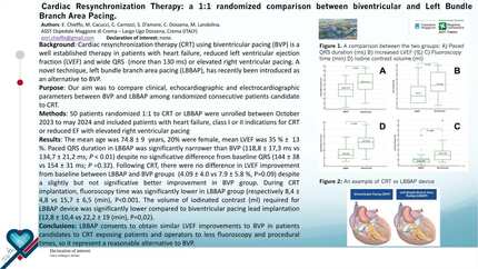 Cardiac resynchronization therapy: a 1:1 randomized comparison of biventricular and left bundle branch pacing