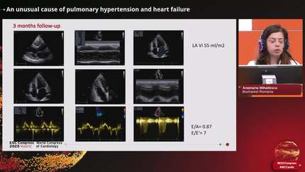 An unusual cause of pulmonary hypertension and heart failure