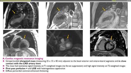 Presentation thumbnail