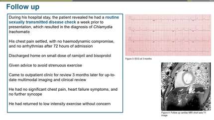 A young man with myocarditis in the setting of a sexually transmitted infection