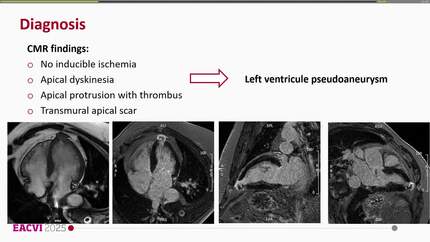 Presentation thumbnail