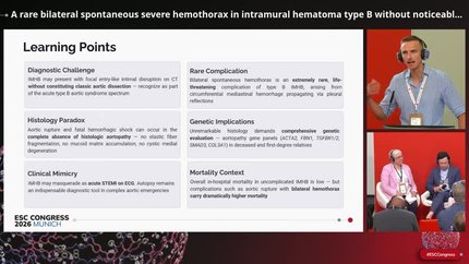 Acute aortic syndromes and catastrophic presentations