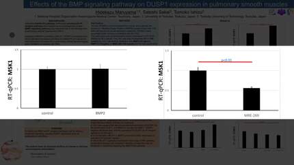 Effects of the BMP signaling pathway on DUSP1 expression in pulmonary smooth muscles
