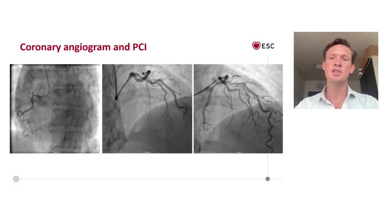 Personalised CVD prevention: the evidence behind the current guidelines. ESC 2021 Clinical Practice Guidelines - Webinar Series
