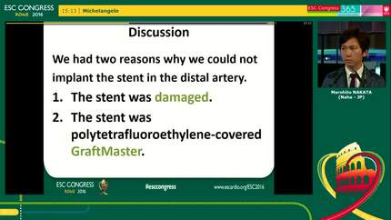 Success in retrieving dislodged stent by using a guiding catheter, which was cut like flare during intervention to coronary artery perforation