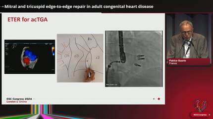 Presentation thumbnail