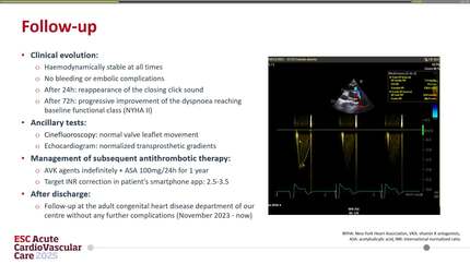 Diagnosis and medical management of a mechanical heart valve obstructive thrombosis in the pulmonary position: a challenging approach. 