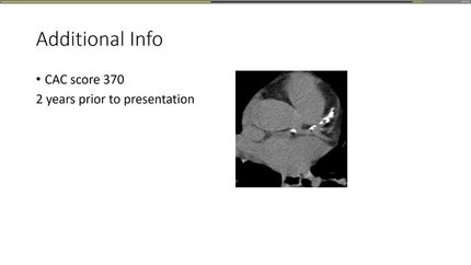 Presentation thumbnail