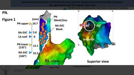 Presentation thumbnail