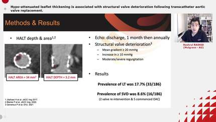 Presentation thumbnail