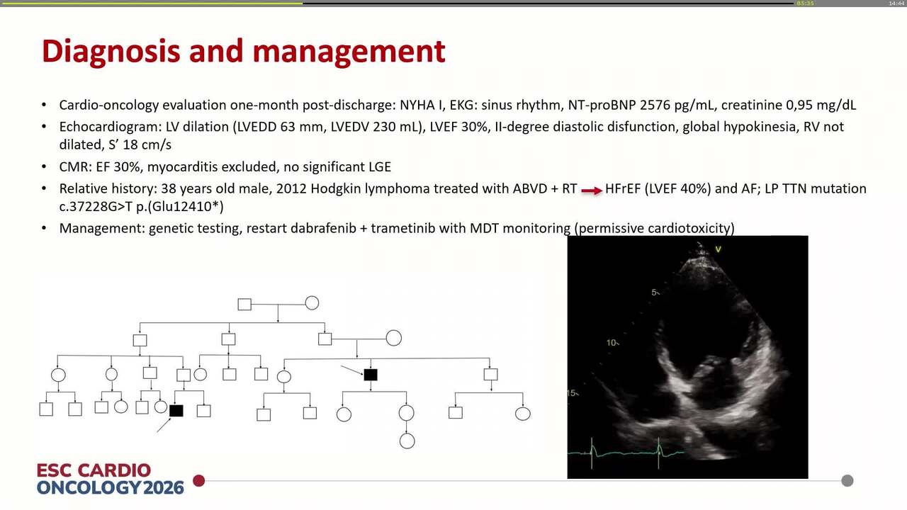 Cancer treatments and one titin variant: multiple hits to the heart